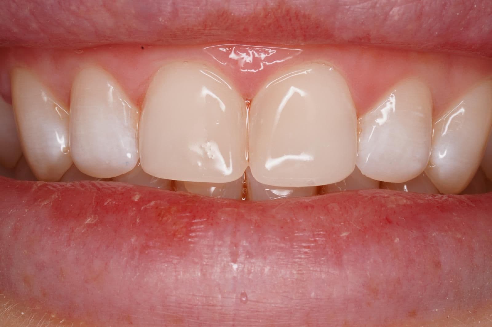 Why Regular Dental Check-ups Are Non-Negotiable