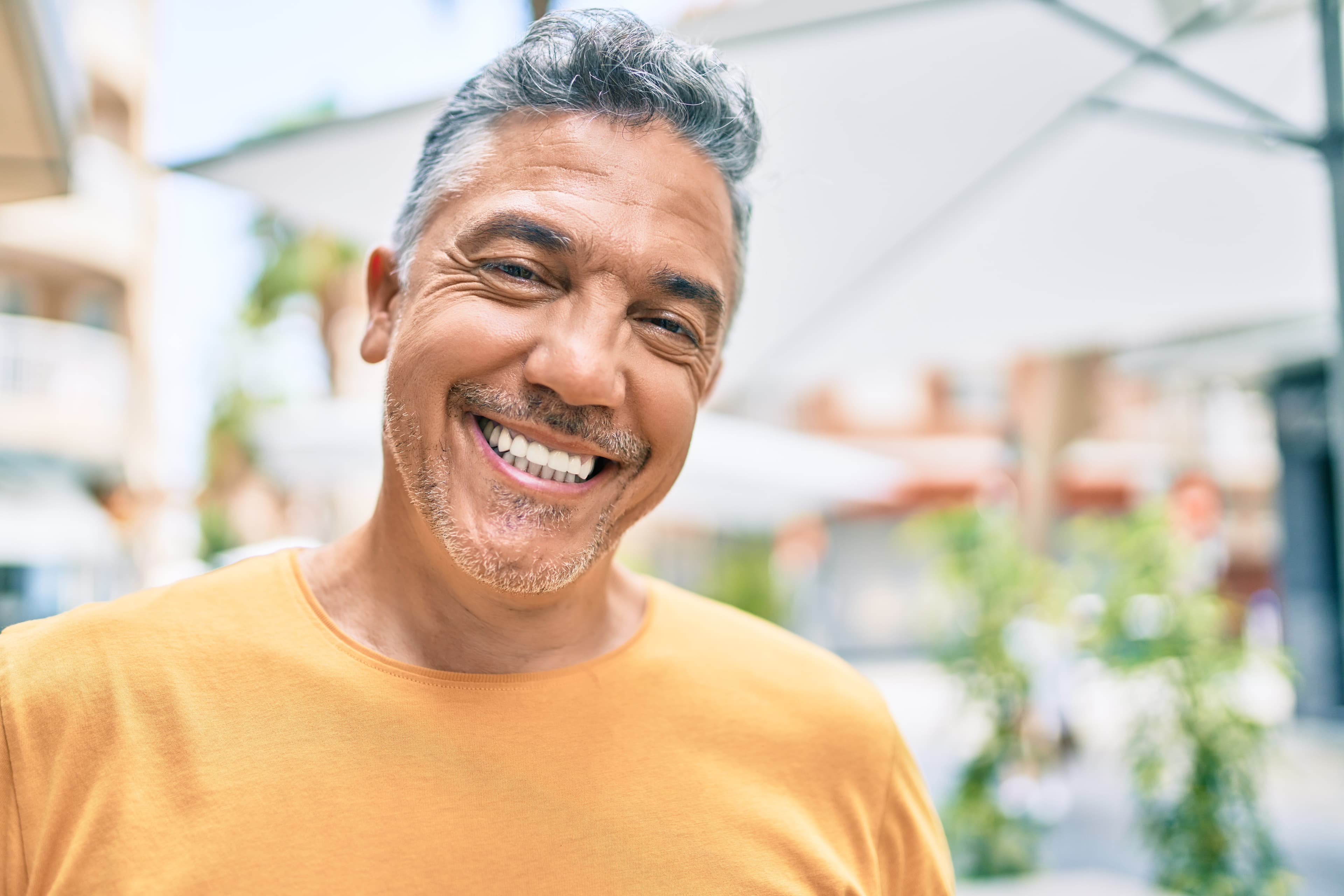 White Fillings vs Silver Fillings in London: What to Know Before You Replace