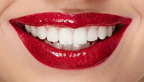 Teeth Whitening